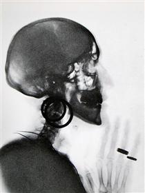 X-Ray of M.O.'s Skull - Meret Oppenheim